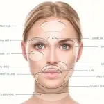 Woman's face marked for areas that can be helped using PDO Thread Lifts.