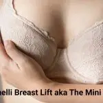 Woman in bra holding up one breast to replicate the affects of a Benelli Breast Lift.