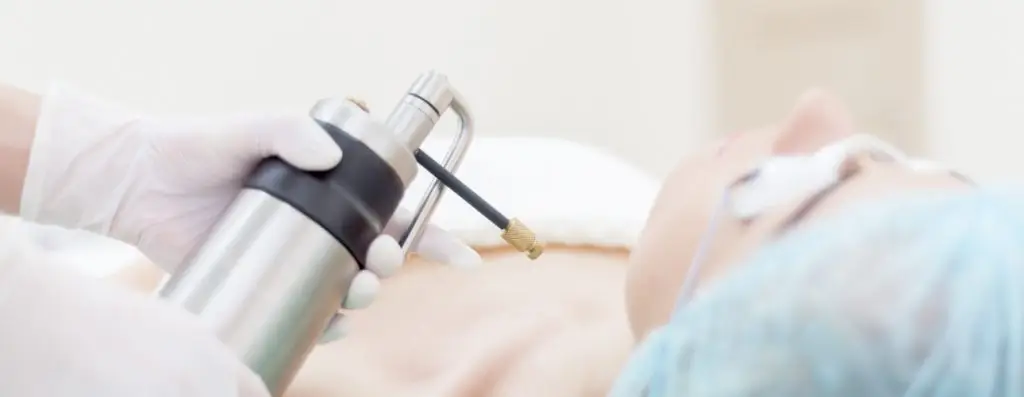 Cryosurgery
