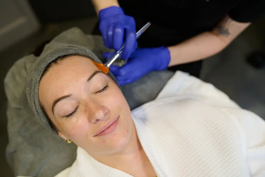 Chemical Peels Charlotte, NC