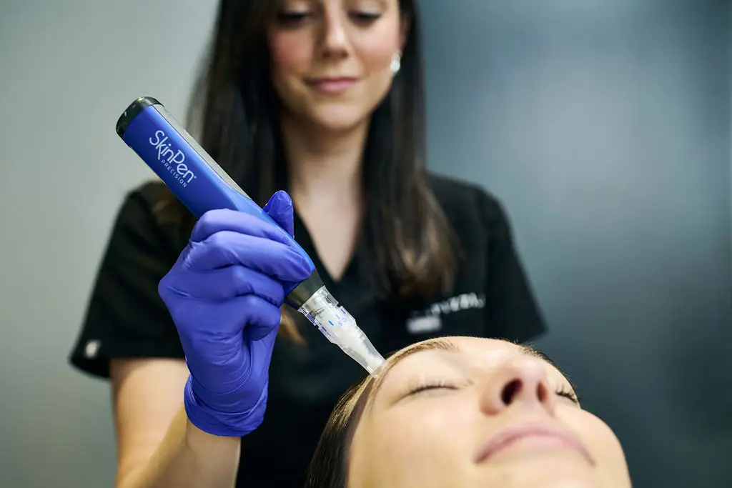 microneedling