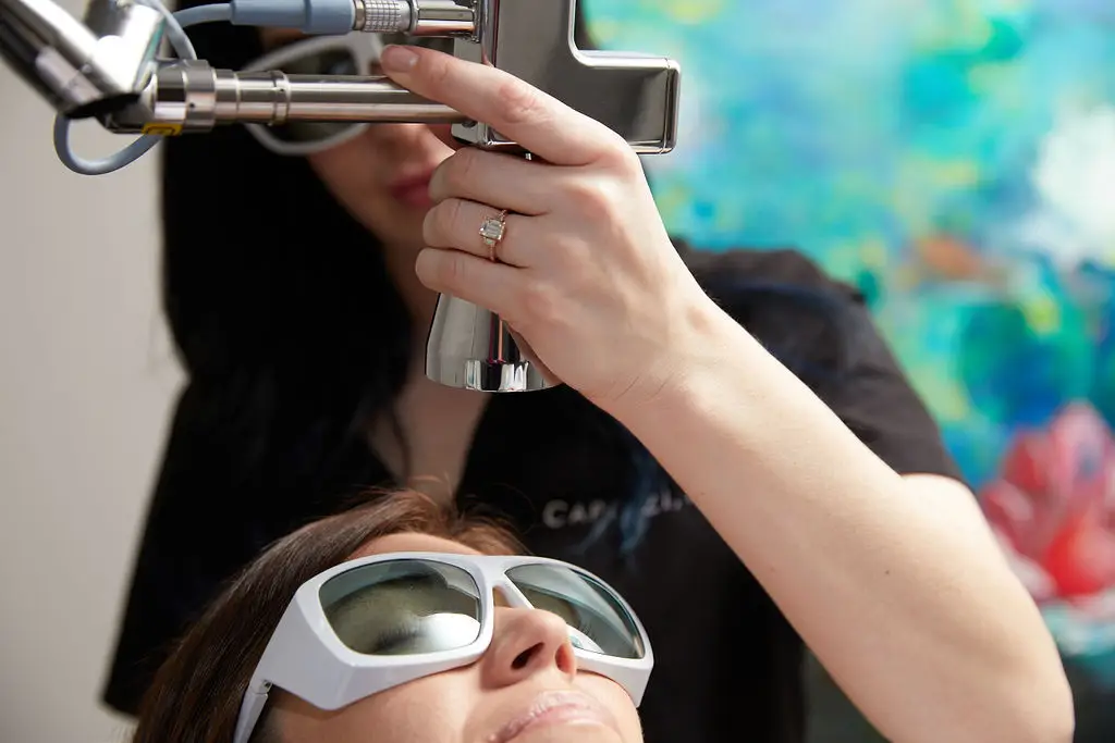MicroLaserPeel® treatment in Charlotte at Capizzi MD Med Spa