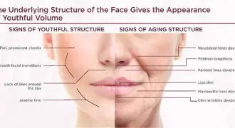 Sculptra