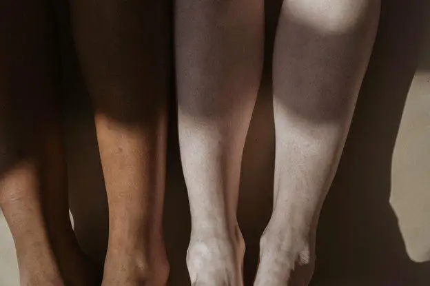 Laser-Hair-Removal-For-All-Skin-Types