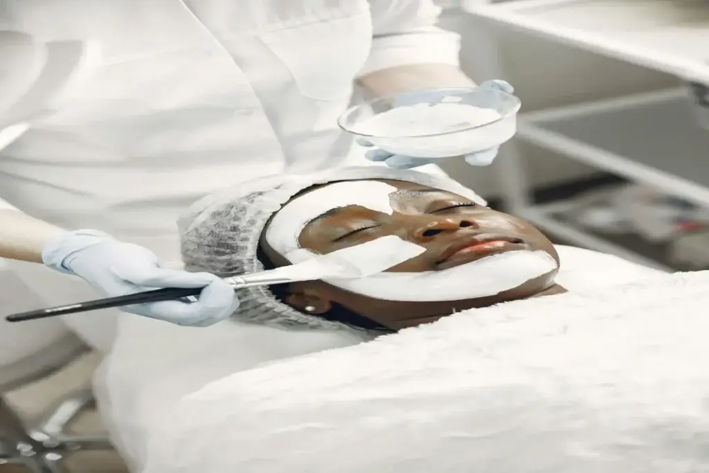 Chemical Peels